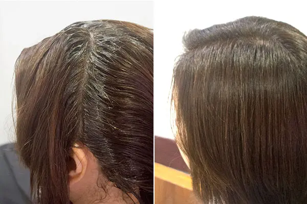 皮膚に優しい白髪染め